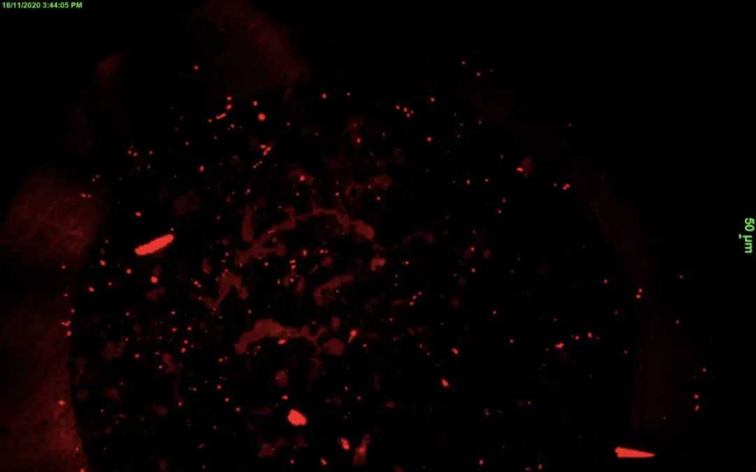 这个城市，每年300万个塑料瓶“从天而降”